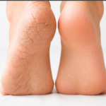 heel socks