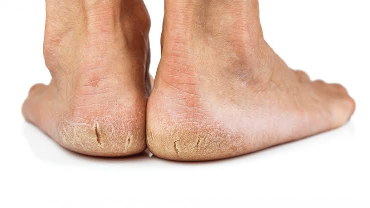 leg
